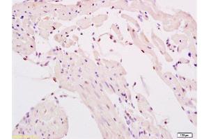 Immunohistochemistry (Paraffin-embedded Sections) (IHC (p)) image for anti-SMAD Specific E3 Ubiquitin Protein Ligase 2 (SMURF2) (AA 601-700) antibody (ABIN753178)