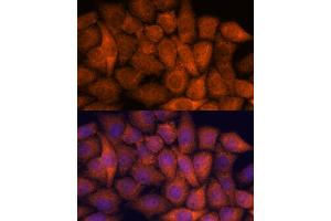 Immunofluorescence analysis of HeLa cells using RP antibody (ABIN7270101) at dilution of 1:100. (RPAP3 抗体  (AA 17-241))