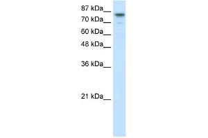 WB Suggested Anti-SMARCA3 Antibody Titration:  2. (HLTF 抗体  (N-Term))