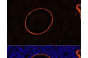 Immunofluorescence analysis of Rat oophoroma cells using ZP3 Polyclonal Antibody at dilution of 1:100. (Zona Pellucida Glycoprotein 3 抗体)