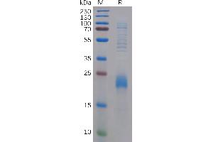 SDS-PAGE (SDS) image for C-Type Lectin Domain Family 2, Member D (CLEC2D) (AA 60-191) protein (His tag) (ABIN7092682)