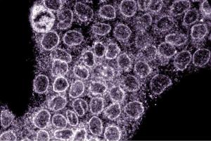 Immunofluorescence staining of A431 cells (Human epithelial carcinoma, ATCC CRL-1555). (NUP88 抗体  (AA 314-425))