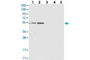 Western blot analysis of Lane 1: RT-4, Lane 2: U-251 MG, Lane 3: Human Plasma, Lane 4: Liver, Lane 5: Tonsil with KCTD20 polyclonal antibody  at 1:250-1:500 dilution. (KCTD20 抗体)