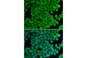 Immunofluorescence analysis of U2OS cells using HSPB2 antibody (ABIN6131082, ABIN6142054, ABIN6142055 and ABIN6219505). (HSPB2 抗体  (AA 1-182))