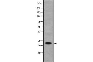 Western blot analysis of RAB1B using COLO205 whole cell lysates (RAB1B 抗体  (Internal Region))