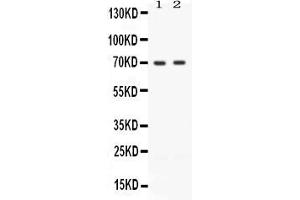 Western blot analysis of ZAP70 expression in JURKAT whole cell lysates ( Lane 1) and CEM whole cell lysates ( Lane 2). (ZAP70 抗体  (Middle Region))