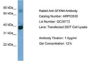 WB Suggested Anti-SFXN4  Antibody Titration: 0. (Sideroflexin 4 抗体  (N-Term))