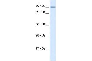 WB Suggested Anti-ZNF537 Antibody Titration:  0. (TSHZ3 抗体  (Middle Region))