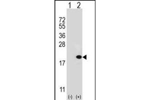 Western blot analysis of UBE2V1 (arrow) using rabbit polyclonal UBE2V1 Antibody  (ABIN388931 and ABIN2837878). (UBE2V1 抗体  (C-Term))