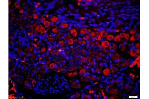 Paraformaldehyde-fixed, paraffin embedded mouse embryo tissue, Antigen retrieval by boiling in sodium citrate buffer(pH6) for 15min, Block endogenous peroxidase by 3% hydrogen peroxide for 30 minutes, Blocking buffer (normal goat serum) at 37°C for 20min, Antibody incubation with Rabbit Anti-P2Y9 Polyclonal Antibody, Unconjugated  at 1:200 overnight at 4°C, followed by a conjugated secondary and DAB staining (LPAR4 抗体  (AA 175-270))