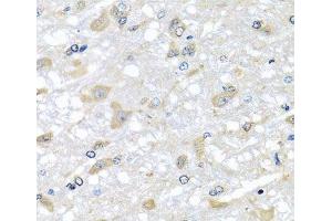 Immunohistochemistry of paraffin-embedded Rat brain using RPLP1 Polyclonal Antibody at dilution of 1:100 (40x lens). (RPLP1 抗体)