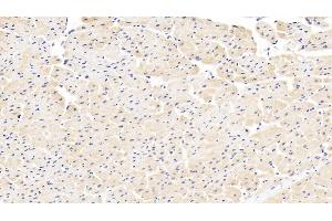 Detection of DBI in Human Cardiac Muscle Tissue using Polyclonal Antibody to Diazepam Binding Inhibitor (DBI) (Diazepam Binding Inhibitor 抗体  (AA 1-104))