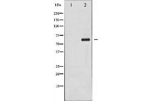 Western Blotting (WB) image for anti-Checkpoint Kinase 2 (CHEK2) (pThr383) antibody (ABIN1844022) (CHEK2 抗体  (pThr383))