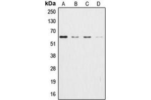 Western blot analysis of AKT expression in HeLa (A), HEK293T (B), NIH3T3 (C), H9C2 (D) whole cell lysates. (AKT1 抗体  (Center))