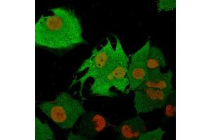 Immunofluorescence (IF) image for anti-Ubiquitin Carboxyl-terminal Esterase L1 (Ubiquitin Thiolesterase) (UCHL1) antibody (ABIN6940850)