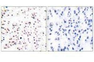 Immunohistochemical analysis of paraffin-embedded human tonsil tissue using MCM5 antibody. (MCM5 抗体)