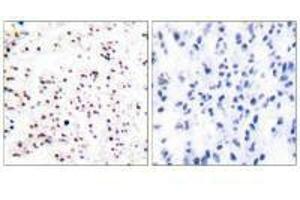 Immunohistochemical analysis of paraffin-embedded human tonsil tissue using MCM5 antibody. (MCM5 抗体)
