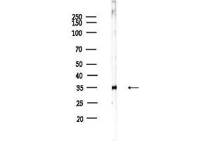anti-Pentraxin 3 (PTX3) (N-Term) antibody