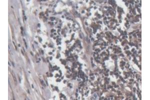 Detection of PRF1 in Human Lymph node Tissue using Polyclonal Antibody to Perforin 1 (PRF1) (Perforin 1 抗体  (AA 32-316))