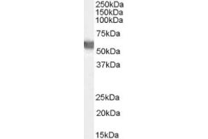 Image no. 1 for anti-Glucose-6-Phosphate Dehydrogenase (G6PD) (AA 308-320), (Internal Region) antibody (ABIN374790) (Glucose-6-Phosphate Dehydrogenase 抗体  (Internal Region))