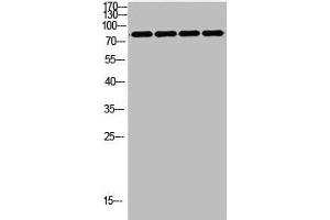 Western Blot analysis of customer's using FOXP1 Antibody Polyclonal Antibody. (FOXP1 抗体  (C-Term))