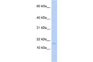ISCA2 antibody used at 1 ug/ml to detect target protein. (ISCA2 抗体)