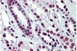 Human Kidney (formalin-fixed, paraffin-embedded) stained with ARID5A antibody ABIN462249 followed by biotinylated goat anti-rabbit IgG secondary antibody ABIN481713, alkaline phosphatase-streptavidin and chromogen. (ARID5A 抗体  (C-Term))