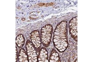 Immunohistochemical staining of human colon with TIGD6 polyclonal antibody  shows strong cytoplasmic positivity in glandular cells, endothelial cells and ganglion cells at 1:200-1:500 dilution. (TIGD6 抗体)