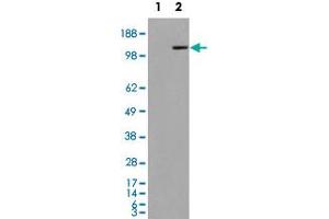 293 overexpressing MAN2A1 and probed with MAN2A1 polyclonal antibody  (mock transfection in first lane), tested by Origene. (alpha-Mannosidase II 抗体  (Internal Region))
