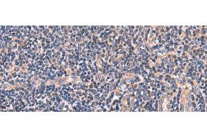 Immunohistochemistry of paraffin-embedded Human tonsil tissue using MYOT Polyclonal Antibody at dilution of 1:65(x200) (Myotilin 抗体)