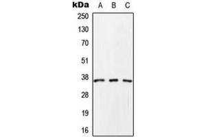 Western blot analysis of SCAMP1 expression in HeLa (A), Raw264. (SCAMP1 抗体  (C-Term))
