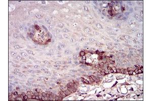 Immunohistochemistry (IHC) image for anti-Ferritin, Light Polypeptide (FTL) (AA 1-175) antibody (ABIN2682991)