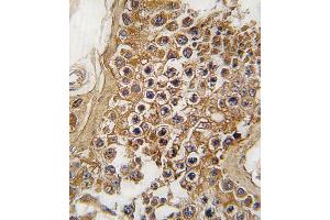 Formalin-fixed and paraffin-embedded human testis tissue reacted with ALK antibody (Center) (ABIN6243477 and ABIN6579002) , which was peroxidase-conjugated to the secondary antibody, followed by DAB staining. (ALK 抗体  (AA 636-666))