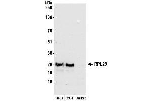 anti-Ribosomal Protein L29 (RPL29) (AA 1-50) antibody