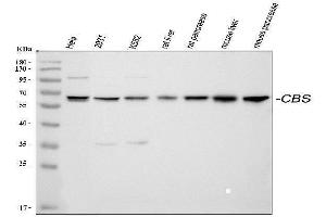 Western blot analysis of CBS using anti-CBS antibody (ABIN3043747).