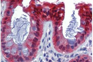Human Colon (formalin-fixed, paraffin-embedded) stained with CASP7 antibody ABIN462357 followed by biotinylated anti-mouse IgG secondary antibody ABIN481714, alkaline phosphatase-streptavidin and chromogen. (Caspase 7 抗体)