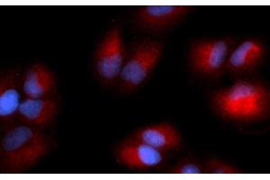 Immunofluorescence (IF) image for anti-Glycyl-tRNA Synthetase (GARS) (AA 43-289) antibody (PE) (ABIN5565503)
