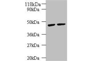 Western blot All lanes: KRT18 antibody at 2 μg/mL Lane 1: K562 whole cell lysate Lane 2: HepG2 whole cell lysate Secondary Goat polyclonal to rabbit IgG at 1/10000 dilution Predicted band size: 49 kDa Observed band size: 49 kDa (Cytokeratin 18 抗体  (AA 102-396))