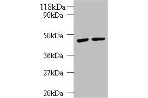 Western blot All lanes: KRT18 antibody at 2 μg/mL Lane 1: K562 whole cell lysate Lane 2: HepG2 whole cell lysate Secondary Goat polyclonal to rabbit IgG at 1/10000 dilution Predicted band size: 49 kDa Observed band size: 49 kDa (Cytokeratin 18 抗体  (AA 102-396))