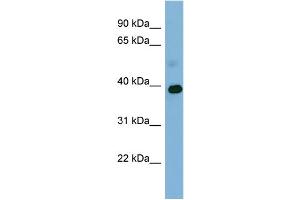 WB Suggested Anti-GAPDH Antibody Titration: 0. (GAPDH 抗体  (Middle Region))