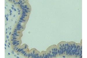 Detection of HMGCS in Mouse Uterus Tissue using Polyclonal Antibody to Hydroxymethylglutaryl Coenzyme A Synthase (HMGCS)