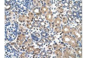 Image no. 1 for anti-Pre-B-Cell Leukemia Transcription Factor 3 (PBX3) (N-Term) antibody (ABIN203364) (PBX3 抗体  (N-Term))