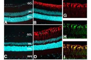Localization of glutamine synthase in the retina. (GLN1 抗体)