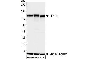 Western Blotting (WB) image for anti-Enhancer of Zeste Homolog 2 (EZH2) (AA 1-154) antibody (ABIN7795766)