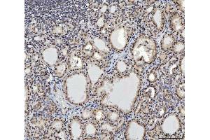 IHC analysis of CTBP2 using anti-CTBP2 antibody (ABIN7601326). (CTBP2 抗体  (AA 321-445))