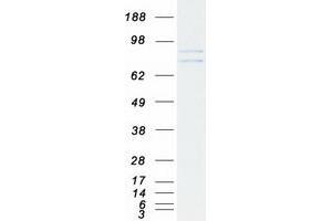 Western Blotting (WB) image for Outer Dense Fiber of Sperm Tails 2 (ODF2) (Transcript Variant 1) protein (Myc-DYKDDDDK Tag) (ABIN2727873)