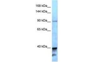 Image no. 1 for anti-Kinesin Family Member 7 (KIF7) (AA 1224-1273) antibody (ABIN6747946) (KIF7 抗体  (AA 1224-1273))