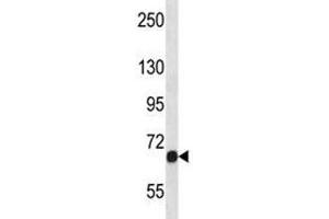 Fgfr1 antibody western blot analysis in NCI-H460 lysate. (FGFR1 抗体  (AA 756-784))