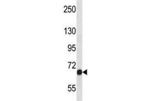 Western Blotting (WB) image for anti-Fibroblast Growth Factor Receptor 1 (FGFR1) (AA 756-784) antibody (ABIN3028659)