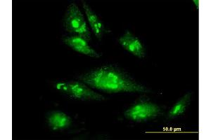 Immunofluorescence (IF) image for anti-Proteasome (Prosome, Macropain) 26S Subunit, ATPase, 4 (PSMC4) (AA 1-418) antibody (ABIN562488)